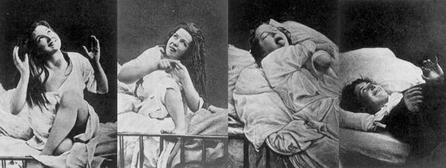 Hysteri er en annen kjent kulturdiagnose fra slutten av 1800-tallet. På det meste var en tidel av pasientene på Gaustad innlagt med diagnosen 'hysteria'